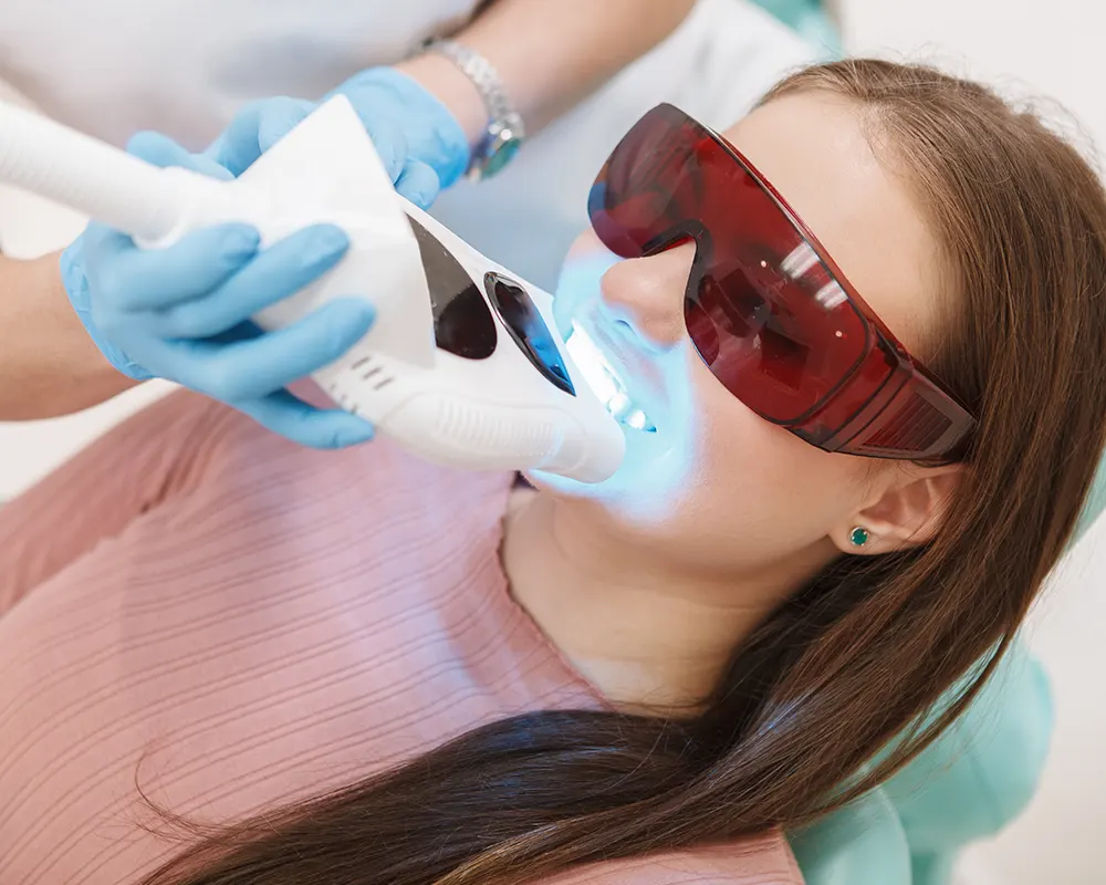 Teeth whitening cost, insurance & payment plans in katy