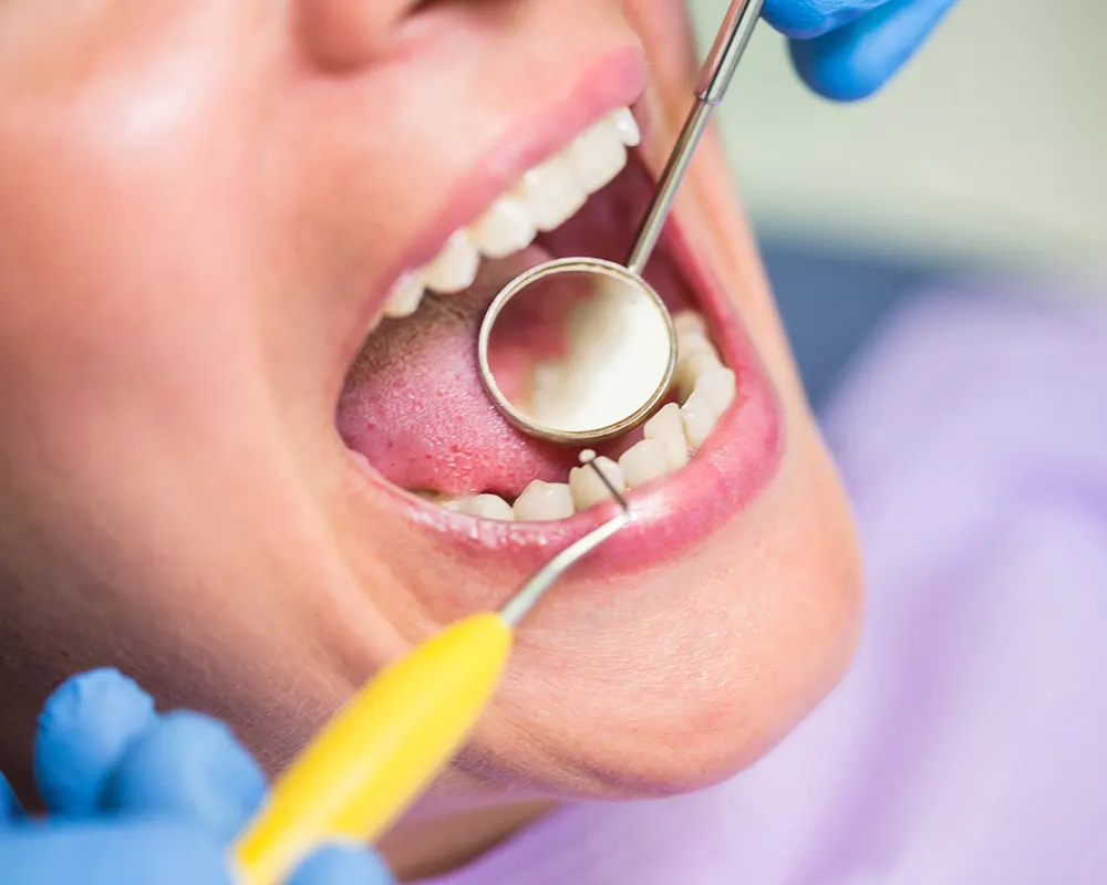 Gum disease treatment cost, insurance & payment