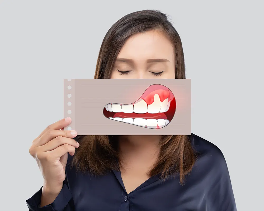 Signs you may need gum disease treatment