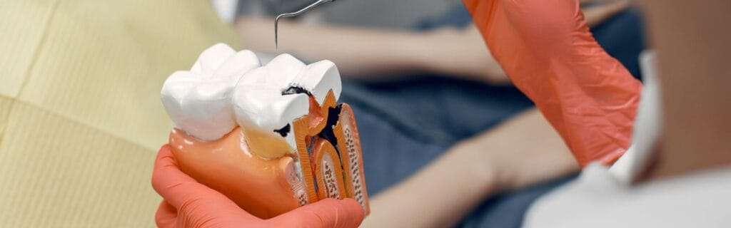 Dental implant surgery guide