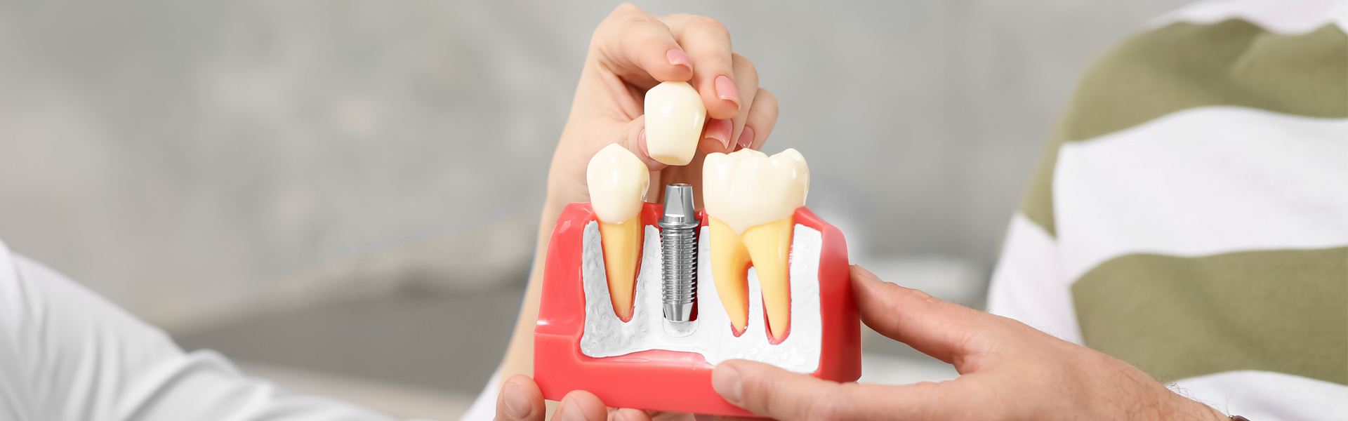 Will I Be in Pain after Getting a Dental Implant?