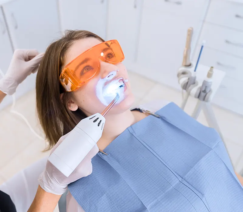 Teeth whitening