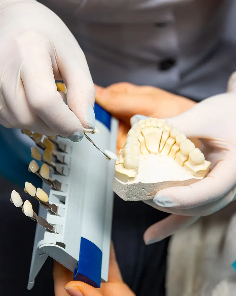 Why choose charm dental katy for crowns and bridges?