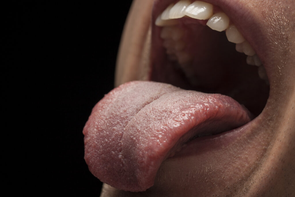 Bumps on the back of the tongue 1