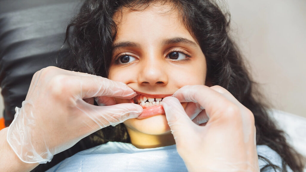 Common signs of cavities in children Cavities in children