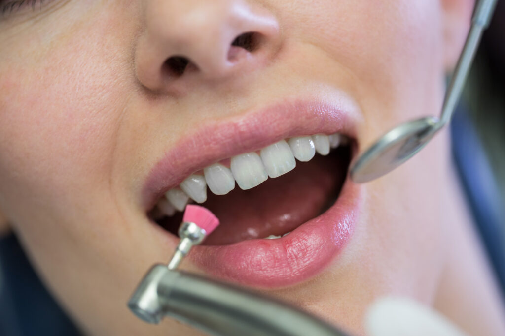 Importance of regular dental visits