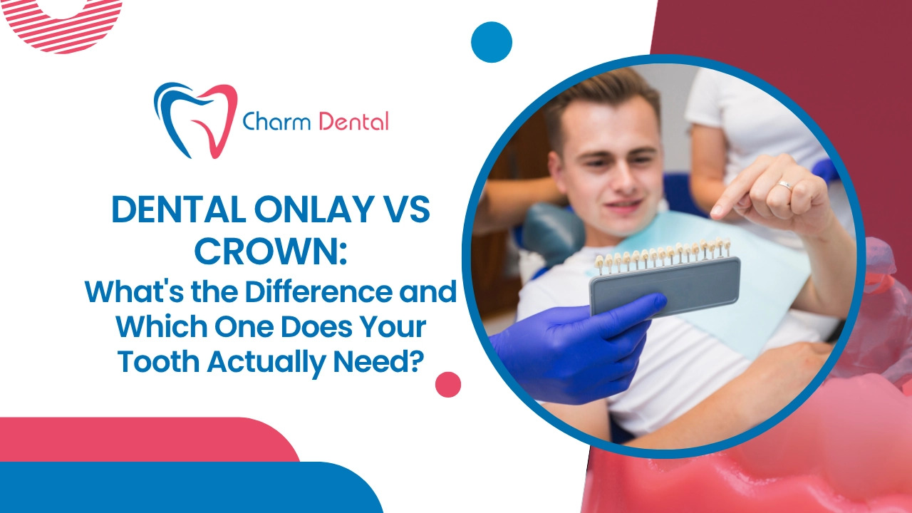 Dental Onlay vs Crown: What's the Difference and Which One Does Your Tooth Actually Need?