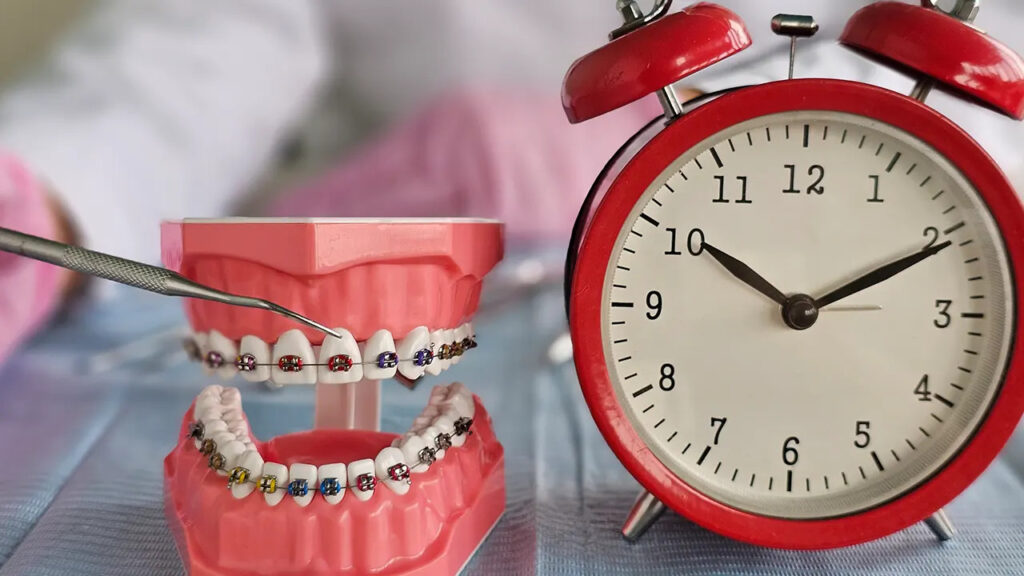 How much do porcelain veneers cost in houston tx per tooth and for full smile makeovers How much do porcelain veneers cost in houston, tx (per tooth and for full smile makeovers)