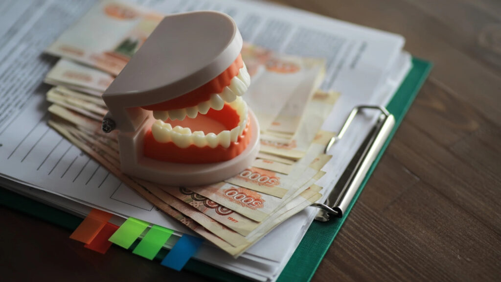 How much do same-day crowns cost in spring, tx?