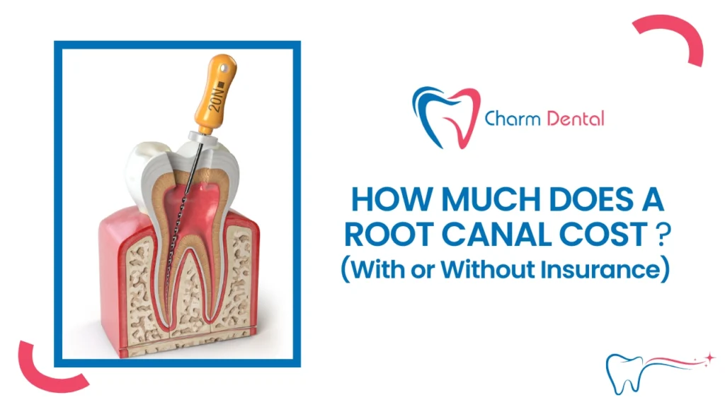 How much does a root canal cost with or without insurance How much does a root canal cost (with or without insurance)