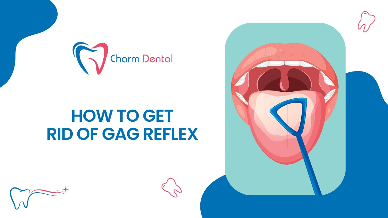 How to get rid of gag reflex?