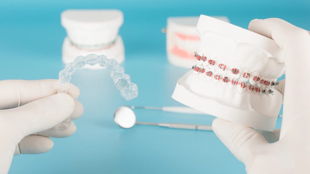 Invisalign for teens vs adults in tomball