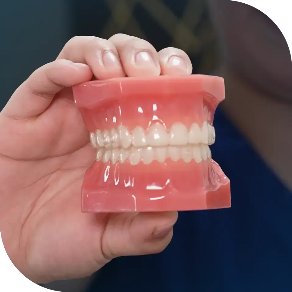 Life changing benefits of dental implants