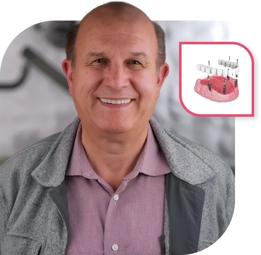 Lifelong benefits of dental implants