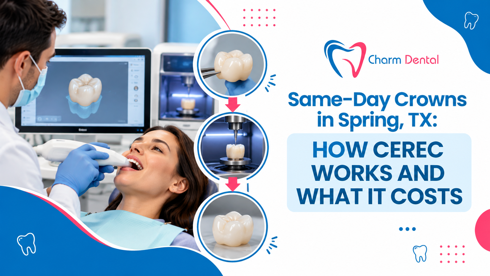 Same day crowns in spring tx how cerec works and what it costs Same-day crowns in spring, tx: how cerec works and what it costs