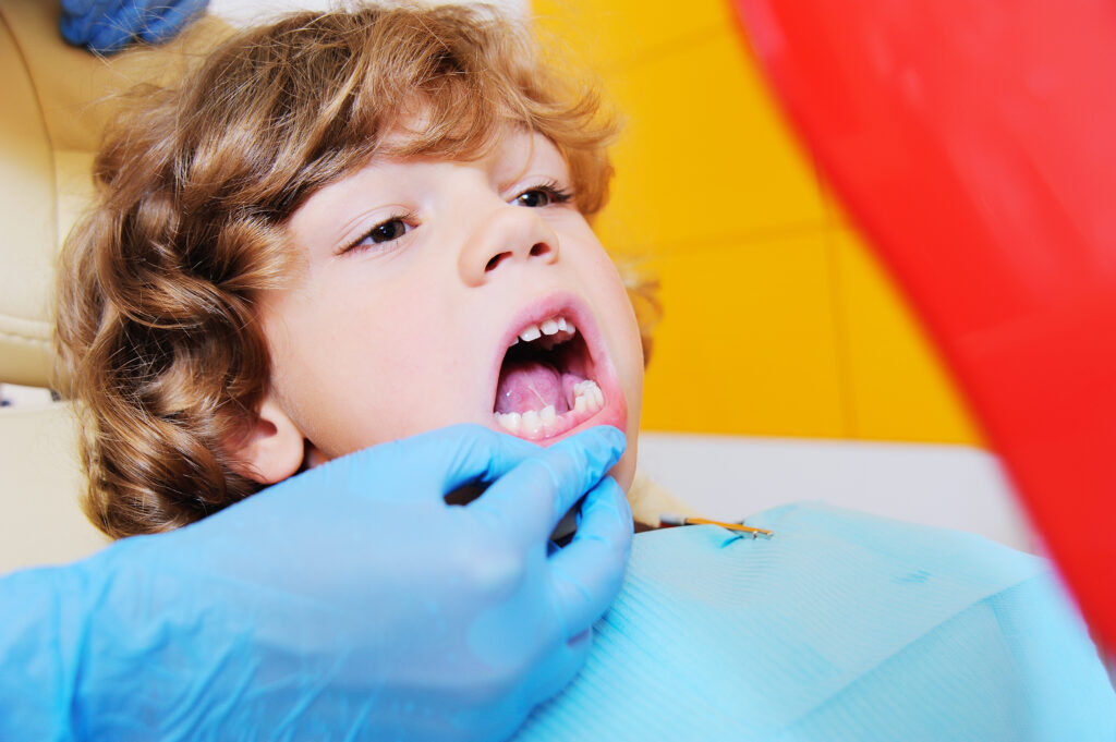 Signs of teeth grinding parents should watch for Sedation for kids at katy