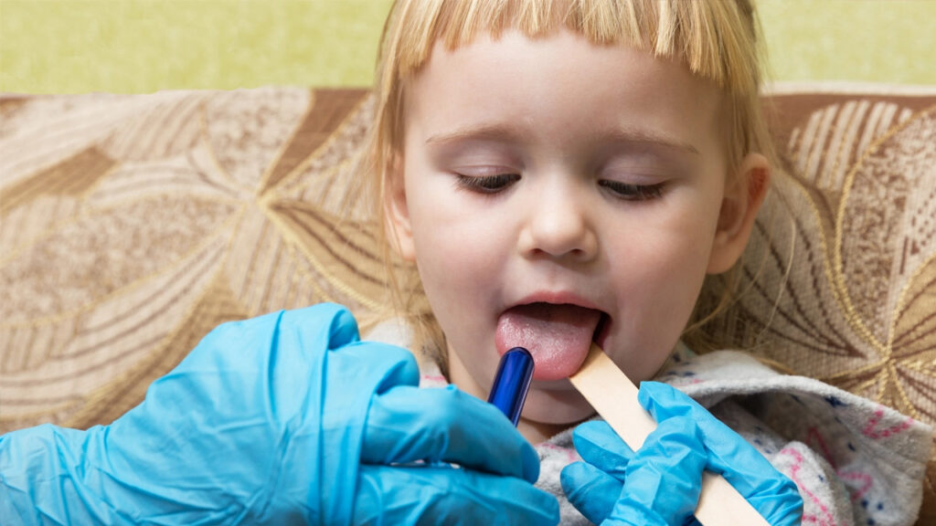 Tongue tie recovery healing and aftercare Tongue tie recovery healing and aftercare
