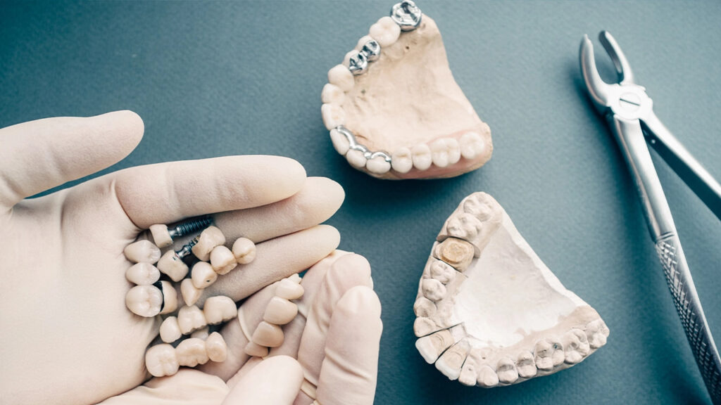 Types of dental crowns and their costs Dental crown cost houston t
