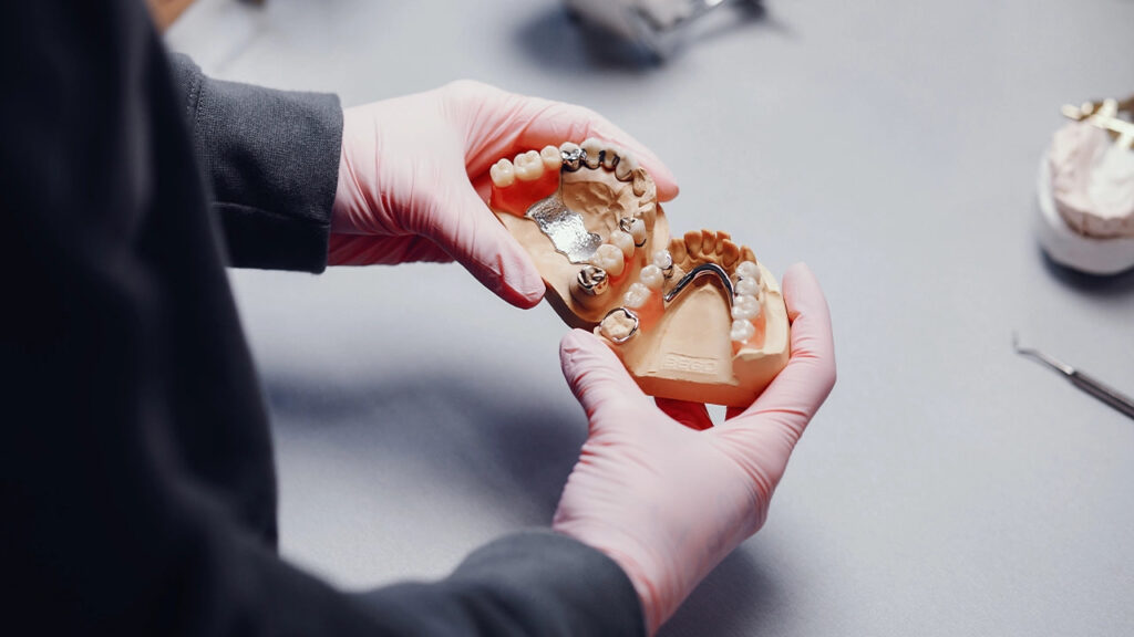 Types of dentures and their cost Types of dentures and their cost