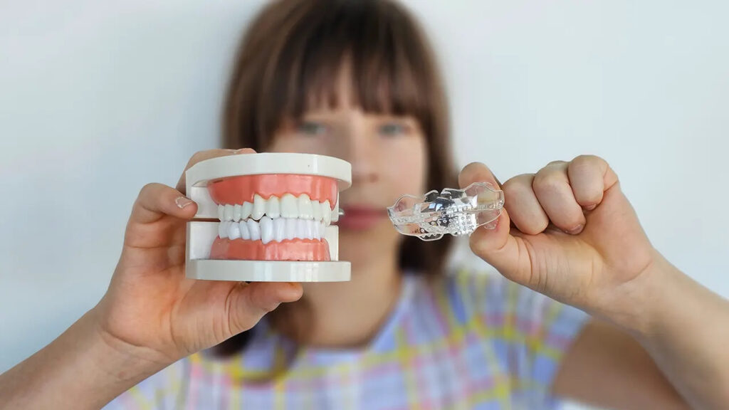 Veneers vs braces or clear aligners when its better to move teeth vs cover them Veneers vs braces or clear aligners: when it’s better to move teeth vs cover them