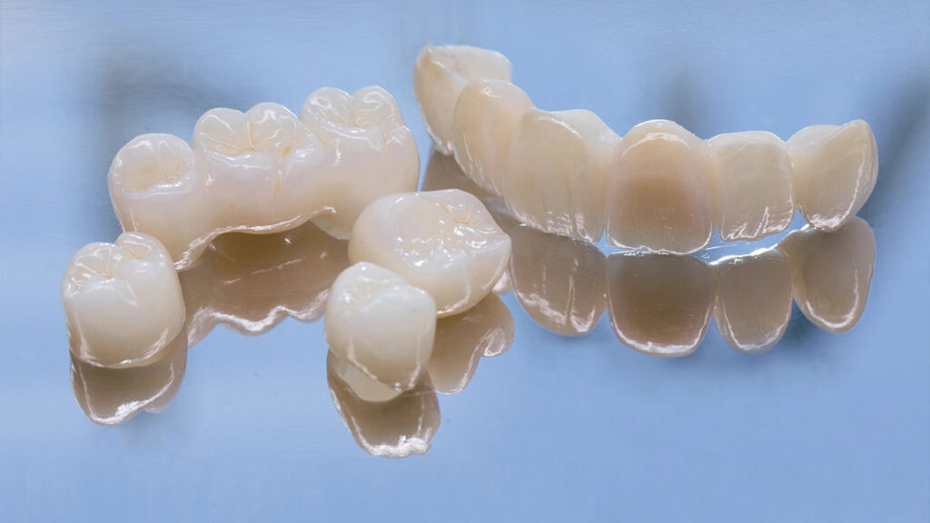 What affects the cost of a dental crown What affects the cost of a dental crown?