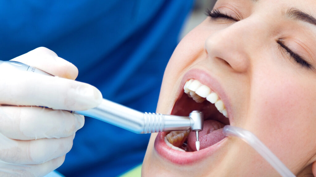 What's included in a routine dental cleaning visit?