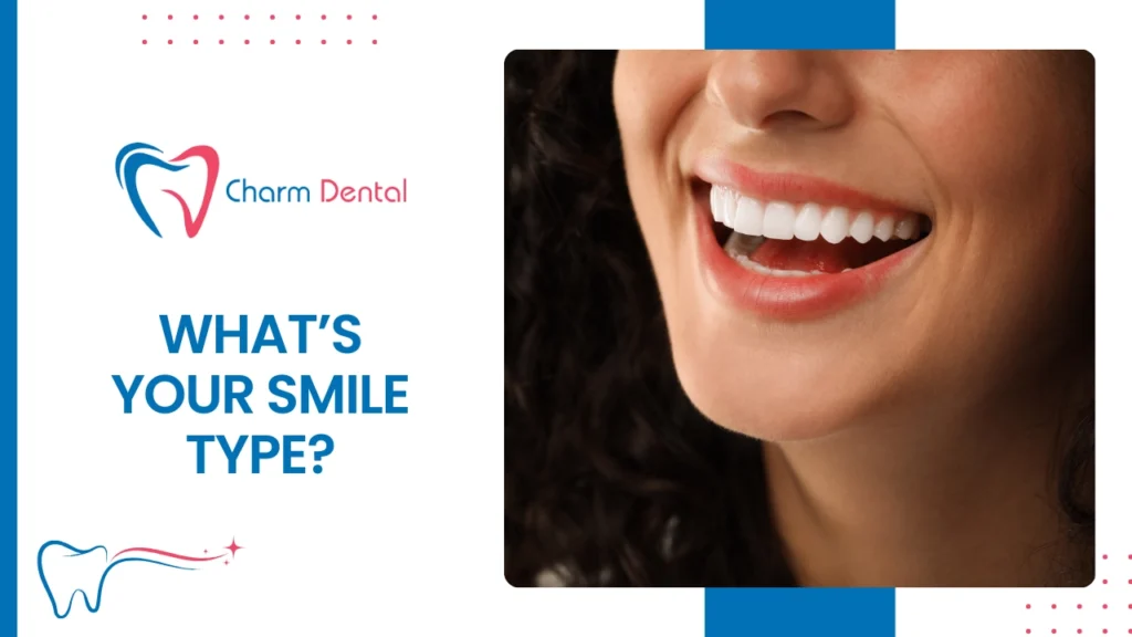 What’s your smile type?    