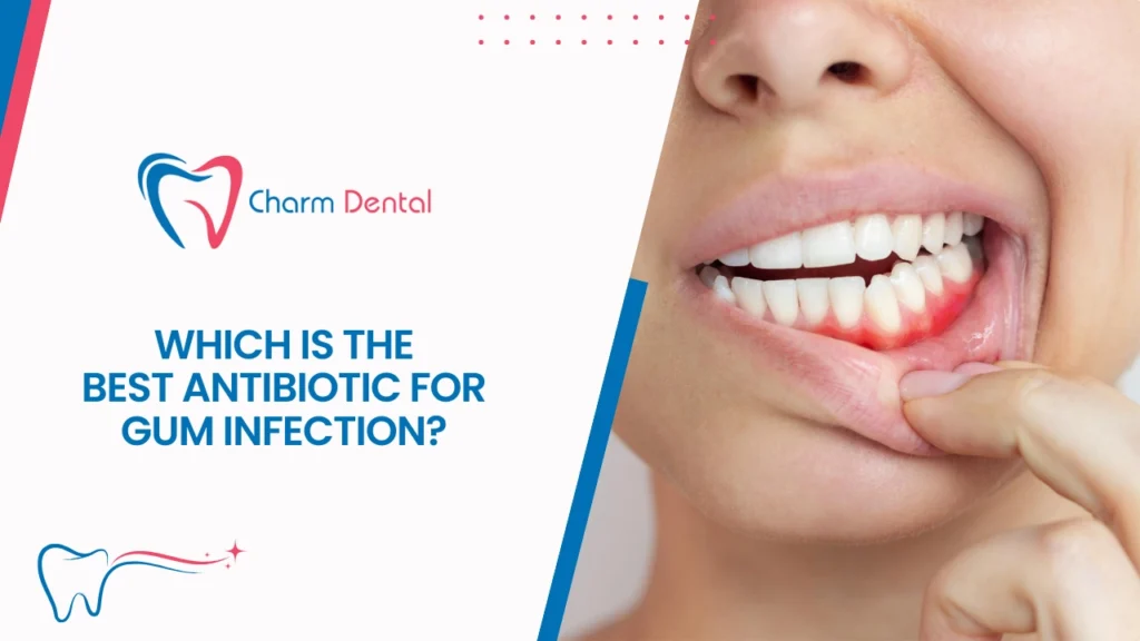 Which is the best antibiotic for gum infection Which is the best antibiotic for gum infection?