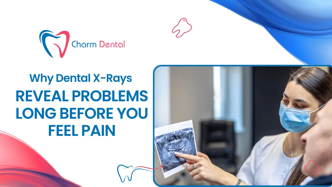 Why dental x rays reveal problems long before you feel pain Why dental x-rays reveal problems long before you feel pain