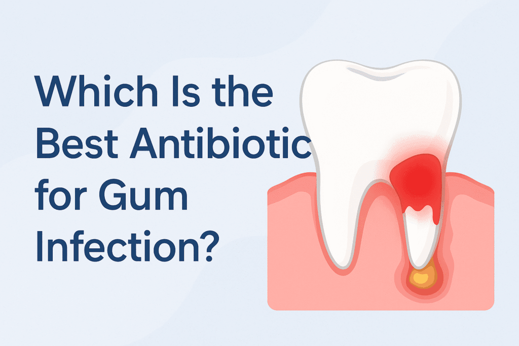 Best antibiotics for gum infection: options & use cases