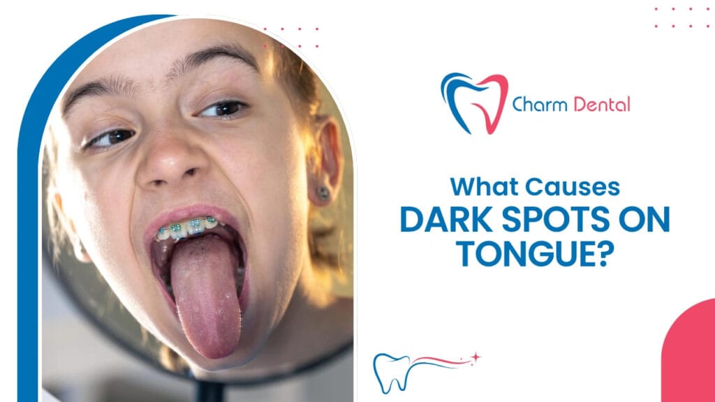 What causes dark spots on tongue