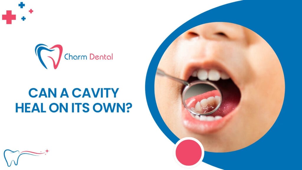 Can a cavity heal on its own