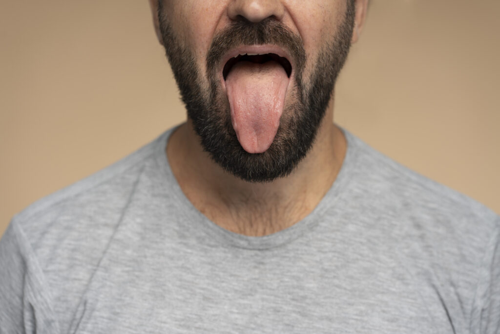 Tongue bumps