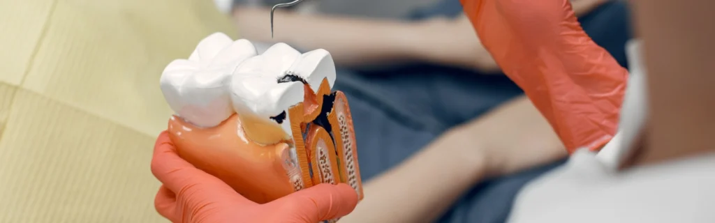 Factors that affect the root canal treatment cost