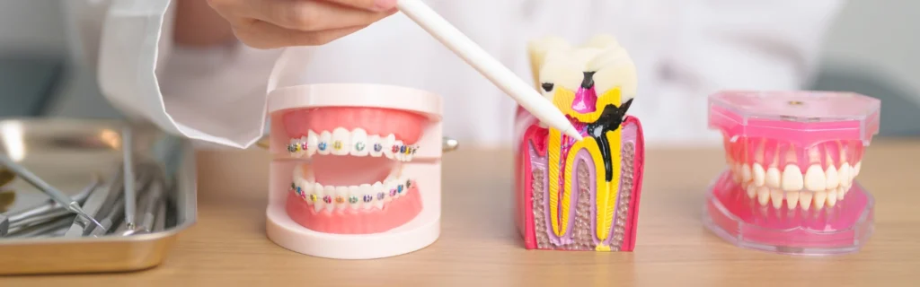 Root canal cost without insurance