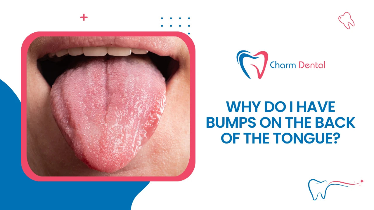 Why do i have bumps on the back of the tonguee Why do i have bumps on the back of the tongue