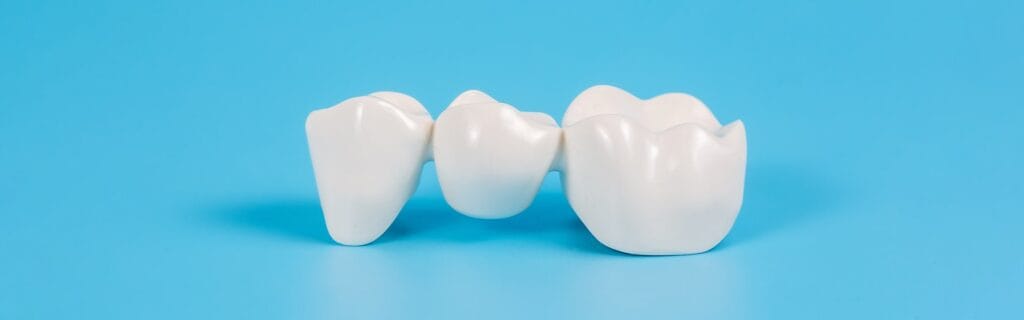 Reasons why veneers are suitable for teeth